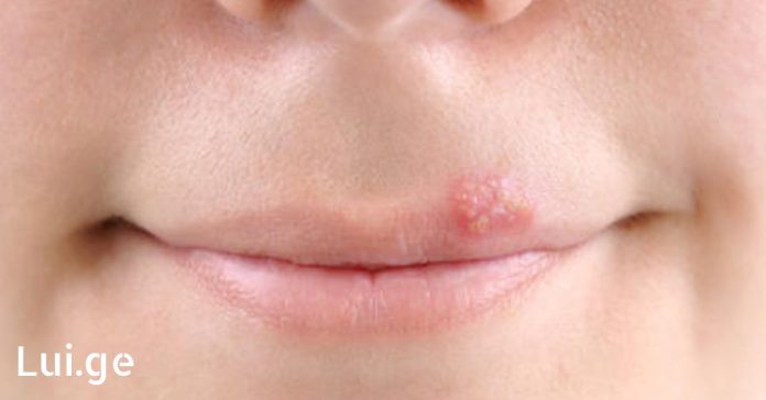 xr:d:DAFDpjCTLwk:1033,j:34064007700,t:22083013