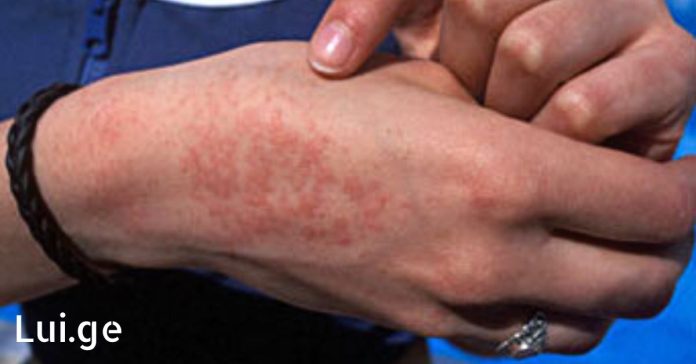 xr:d:DAFDpjCTLwk:1117,j:34703117259,t:22090707