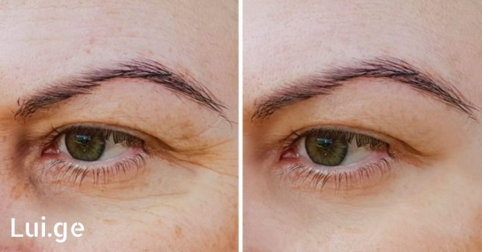 xr:d:DAFDpjCTLwk:1146,j:34975683734,t:22091009