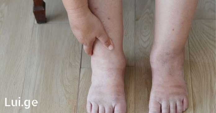 xr:d:DAFDpjCTLwk:1139,j:34890874151,t:22090907