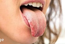 შენი ენის ფერი ძალიან ბევრს მეტყველებს შენს ჯანმრთელობაზე! ნახეთ რისი ამოცნობა შეგიძლიათ მისი დახმარებით!