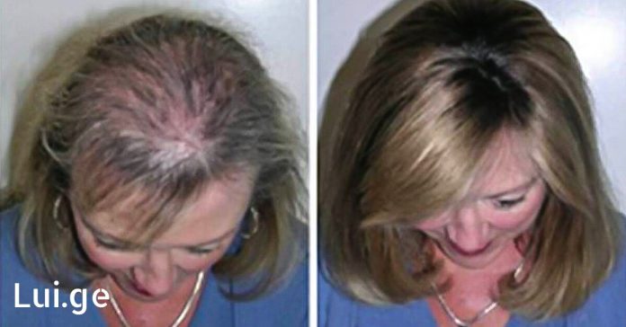 xr:d:DAFDpjCTLwk:984,j:33759050933,t:22082606