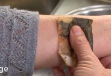 თუ სისხდენის დროს არ არის პირველადი დახმარების ნაკრები, აი რა შეიძლება დაგეხმაროთ ამ სიტუაციაში! – 10 ბუნებრივი საშუალება.