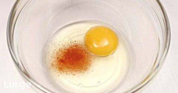 xr:d:DAFDpjCTLwk:614,j:31831265361,t:22073015