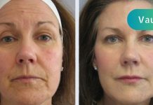 40 წლის შემდეგ ახალგაზრდობა არ მთავრდება! აი, როგორ შეინარჩუნოთ იგი!