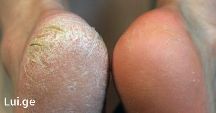 xr:d:DAFDpjCTLwk:13,j:28759356334,t:22061608