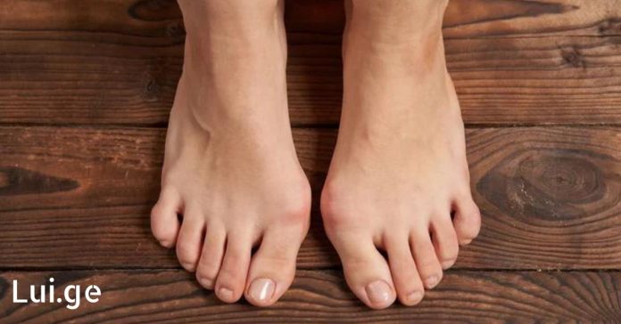 xr:d:DAFDpjCTLwk:69,j:29104590281,t:22062108