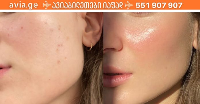 xr:d:DAFDpjCTLwk:1970,j:1031006180,t:22122714