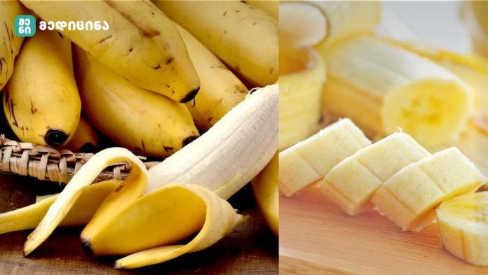 ექიმები ამბობენ, რომ თუ სიცოცხლის ბოლომდე დღეში 2 ბანანს მიირთმევთ, ჯანმრთელობის თითქმის ყველა პრობლემის მოგვარება შეგიძლიათ