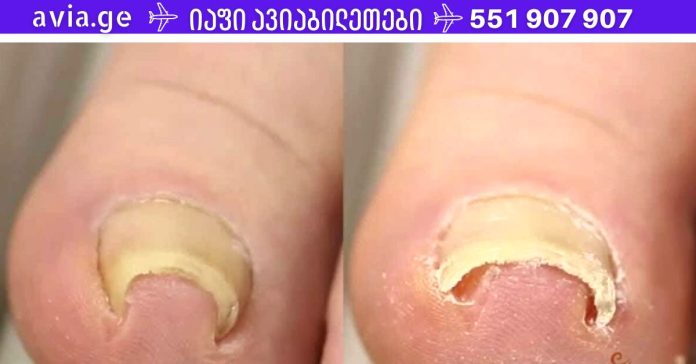 xr:d:DAFDpjCTLwk:1414,j:37293476234,t:22100616