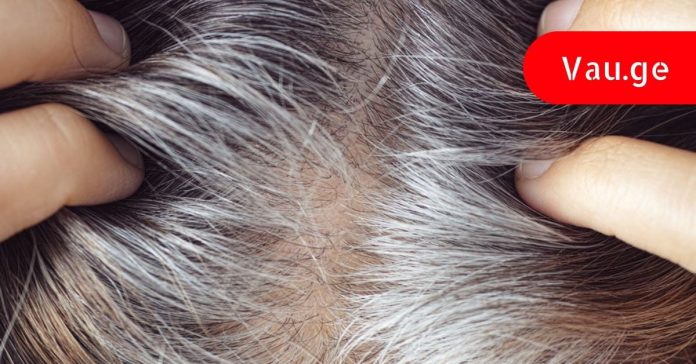 gachagaravebis-mizezei