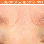 დაიტენიანეთ მშრალი კანი სახლის საუკეთესო საშუალებებით!