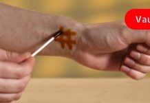 თქვენ ვერც წარმოიდგენთ იოდის ასეთ სარგებელს! მეც არ ვიცოდი ამ პროდუქტს ამდენი სიკეთის მოტანა თუ შეეძლო ადამიანისთვის!