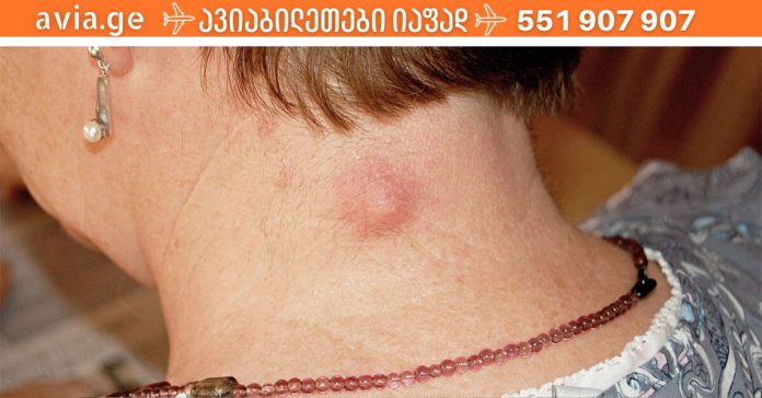 xr:d:DAFDpjCTLwk:1926,j:810570312,t:22122207