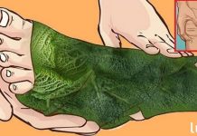 მან ღამღამობით მტკივნეულ ადგილებზე კომბოსტოს ფურცლები დაიდო – ასე მოხდა მეორე დილით! შედეგი ნამდვილად გაგაოცებთ!