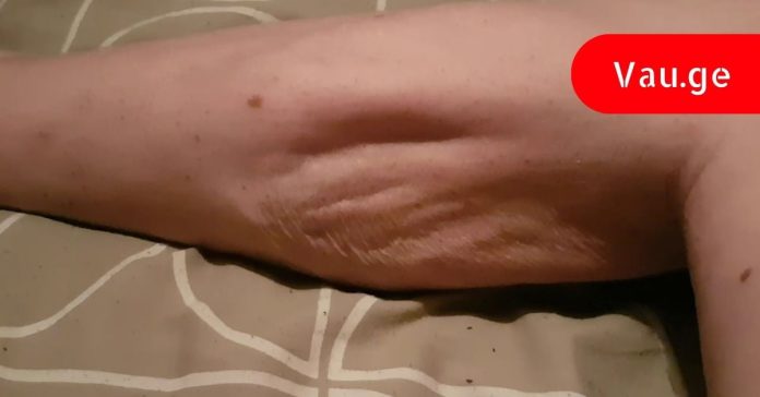 magniumis-naklebobis-nishnebi