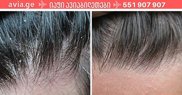 xr:d:DAFDpjCTLwk:1718,j:41546779928,t:22112010