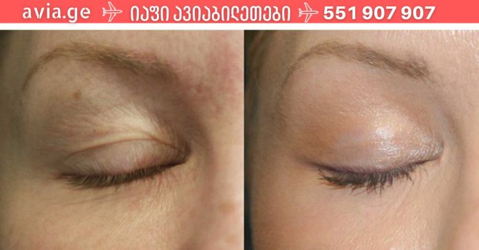 xr:d:DAFDpjCTLwk:1741,j:42014494862,t:22112410