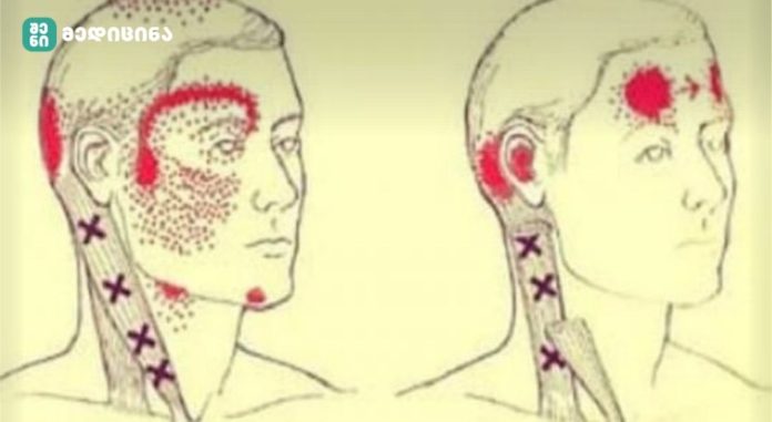 თავის ტკივილი-ვიტამინები