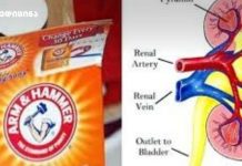 აი, რა მოუვა თქვენს თირკმელებს თუ ნახევარ კოვზ საკვებ სოდას მიიღებთ… თირკმელები