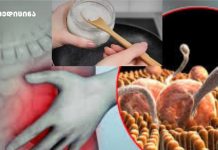 როგორ მოვიშოროთ პარაზიტები, ვირუსები და სოკოვანი ინფექციები! და როგორ მოვახდინოთ ორგანიზმის დეტოქსიკაცია ქოქოსის ზეთით? როგორ მოვიშოროთ პარაზიტები, ვირუსები და სოკოვანი ინფექციები! და როგორ მოვახდინოთ ორგანიზმის დეტოქსიკაცია ქოქოსის ზეთით?