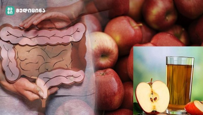 naclavebis modzraoba აქედან მხოლოდ 1 ჭიქას შეუძლია ნაწლავის მოძრაობა სულ რაღაც 30 წუთში! Სცადე! შედეგი გარანტირებულია!