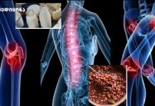 ძვლების დამცველი – გაქვს ოსტეოპოროზი? შეაჩერე ახლავე! ძვლების დამცველი - გაქვს ოსტეოპოროზი? შეაჩერე ახლავე!