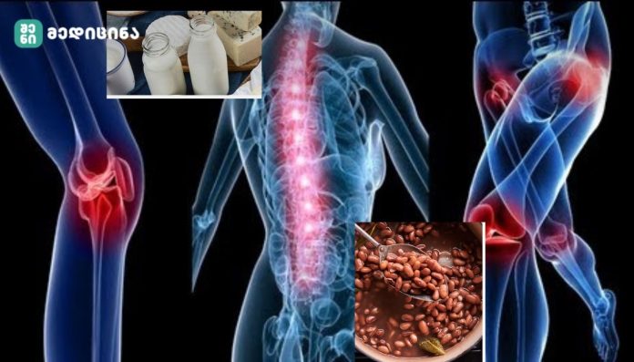 ძვლების დამცველი - გაქვს ოსტეოპოროზი? შეაჩერე ახლავე!