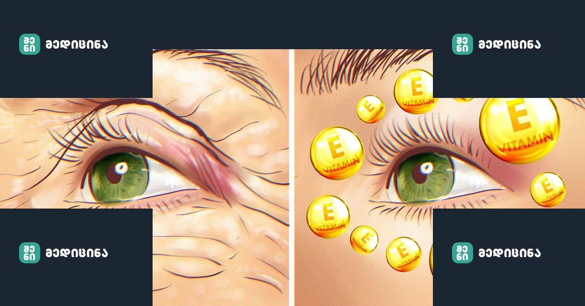 1 161