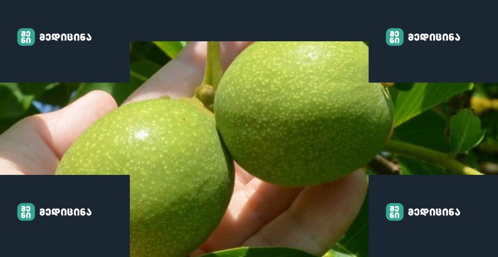 3 75 1024x623 1 e1660892764504