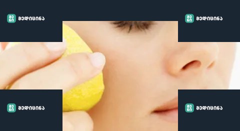 55000a2918306 beauty uses lemon orig master 1