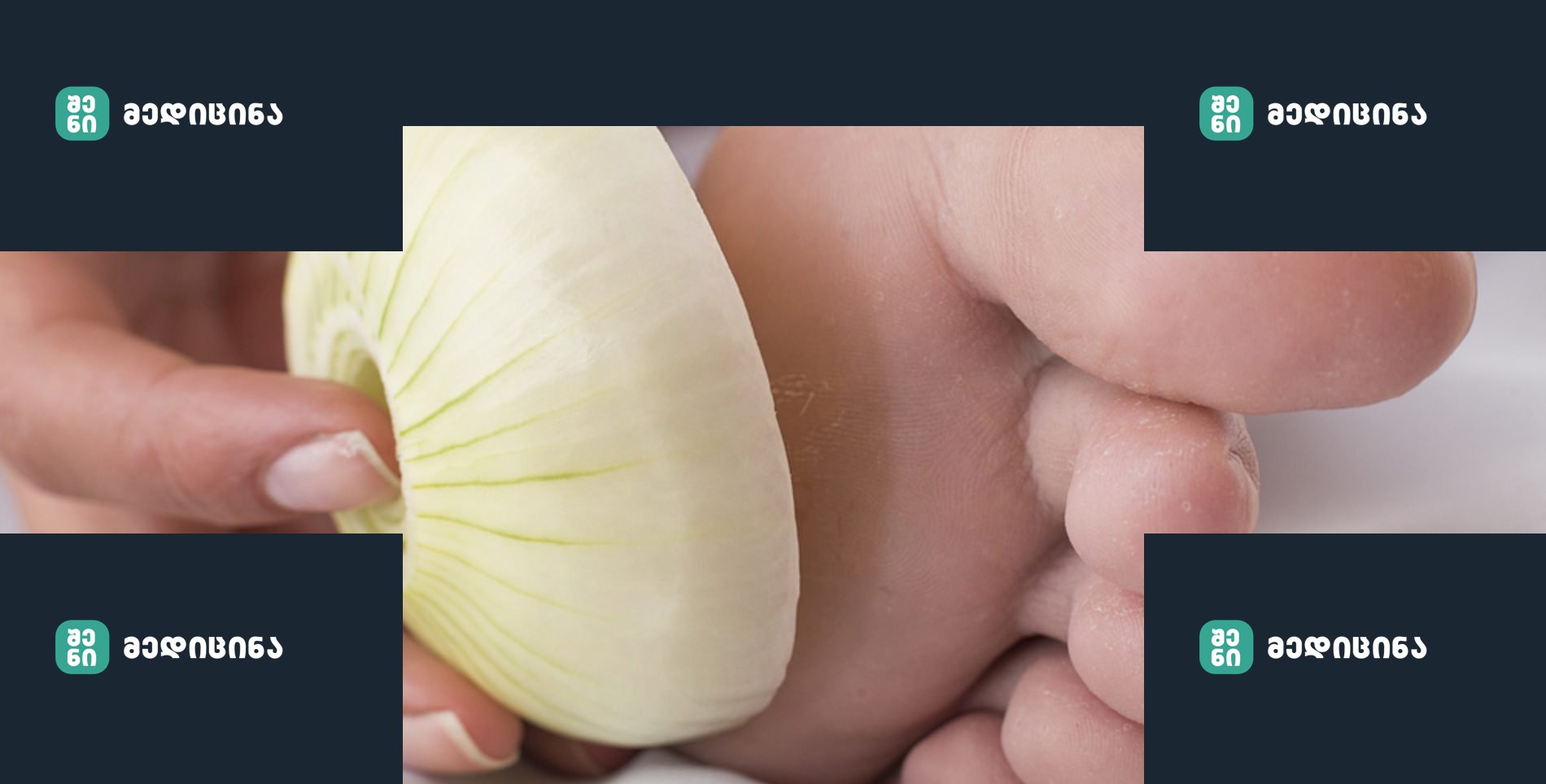 LeadingSpa Zwiebelsocke 1 347430 1 5924ac6f385fb2e232a0901e2a812082 e1660639555935