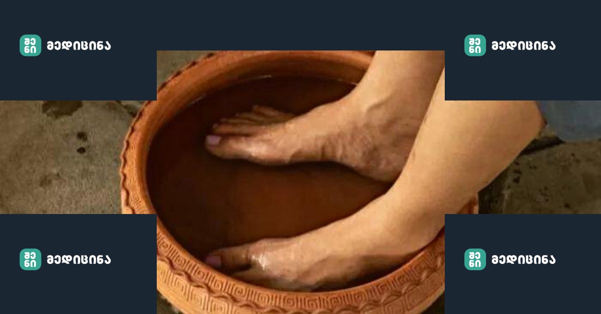 Lui.ge 1 14