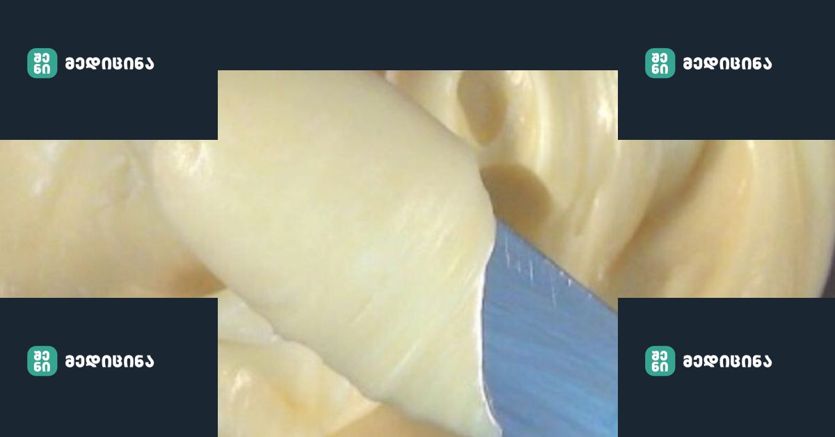 Lui.ge 18 3