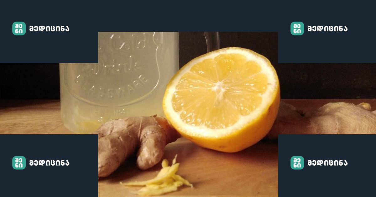 Lui.ge 2 9