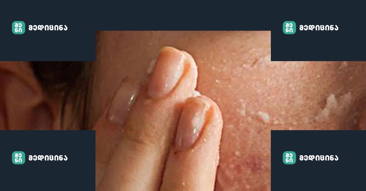 Lui.ge 20 2