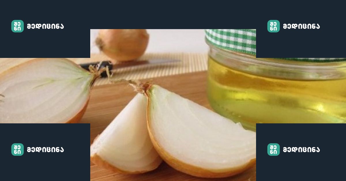 Lui.ge 3 9