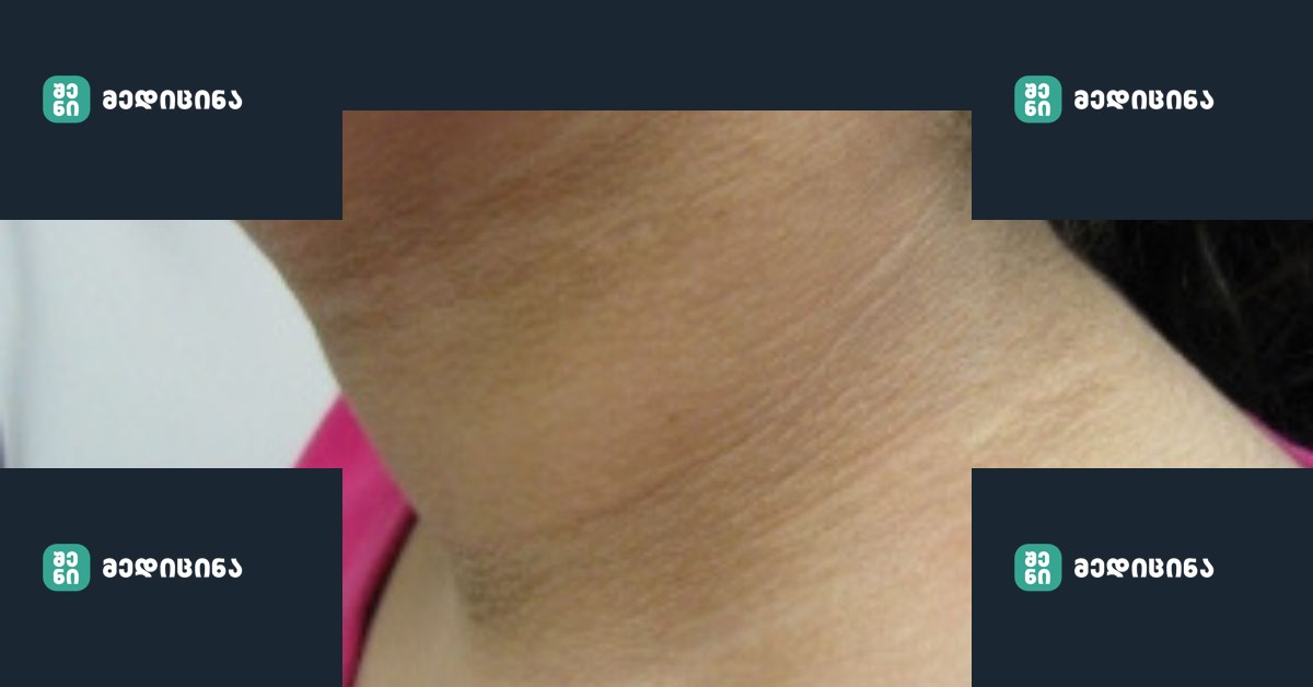 Lui.ge 4 9