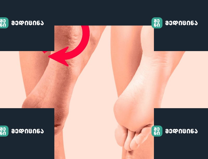 content пятки