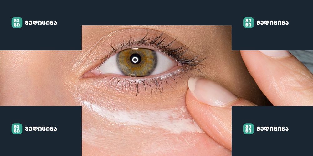 fixeyebags main 1507898066