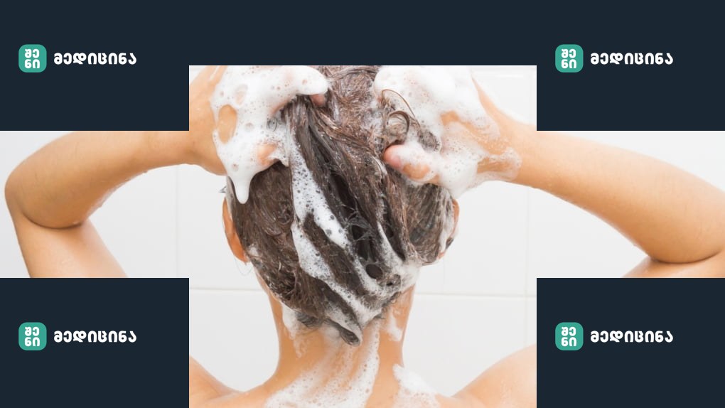 გამოიყენეთ საცხობი სოდა შამპუნის ნაცვლად და თქვენი თმის ზრდის სისწრაფე გაგაოცებთ! 1 image