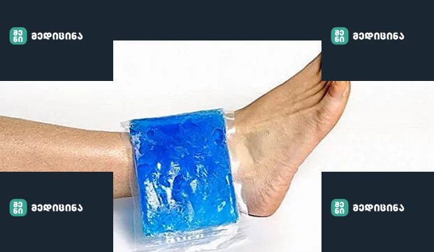 important facts about hairline fractures 2 e1651929617887