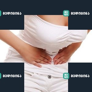 lui 34 1