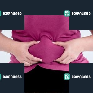 lui 4