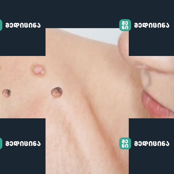 lui.ge 2