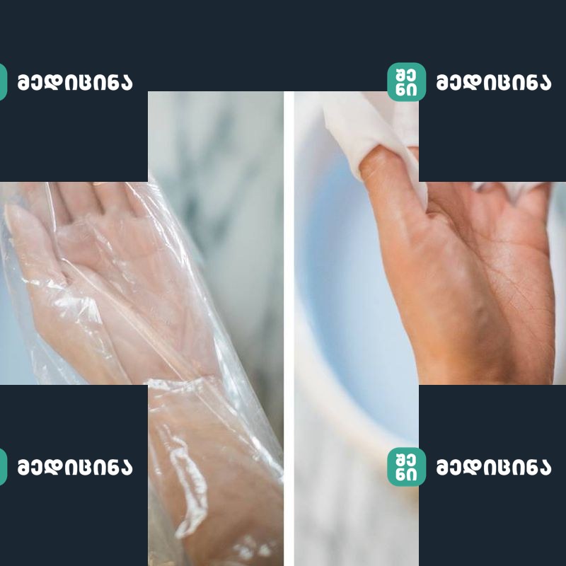 წლები ვებრძოდი ზამთარში ხელების სიმშრალეს, სანამ არ ვიპოვე ეს არაჩვეულებრივი საშუალება! 2 parafini