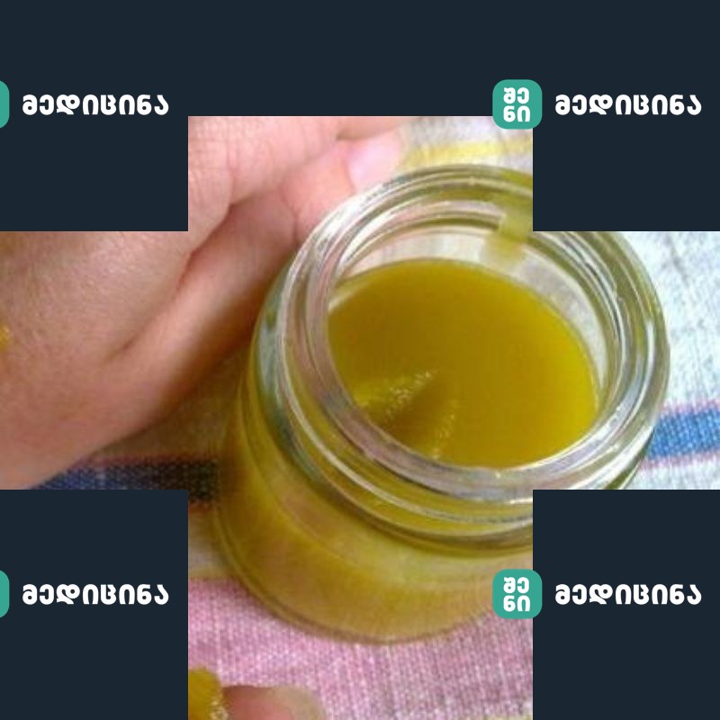 samkurnalo malamo 1