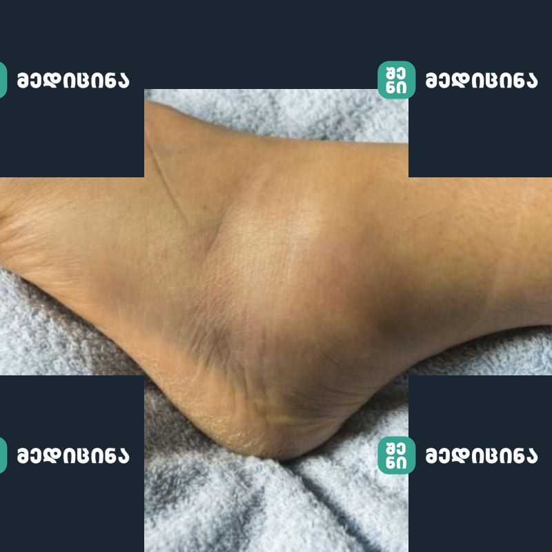 sheshupeba da sitxis shekaveba