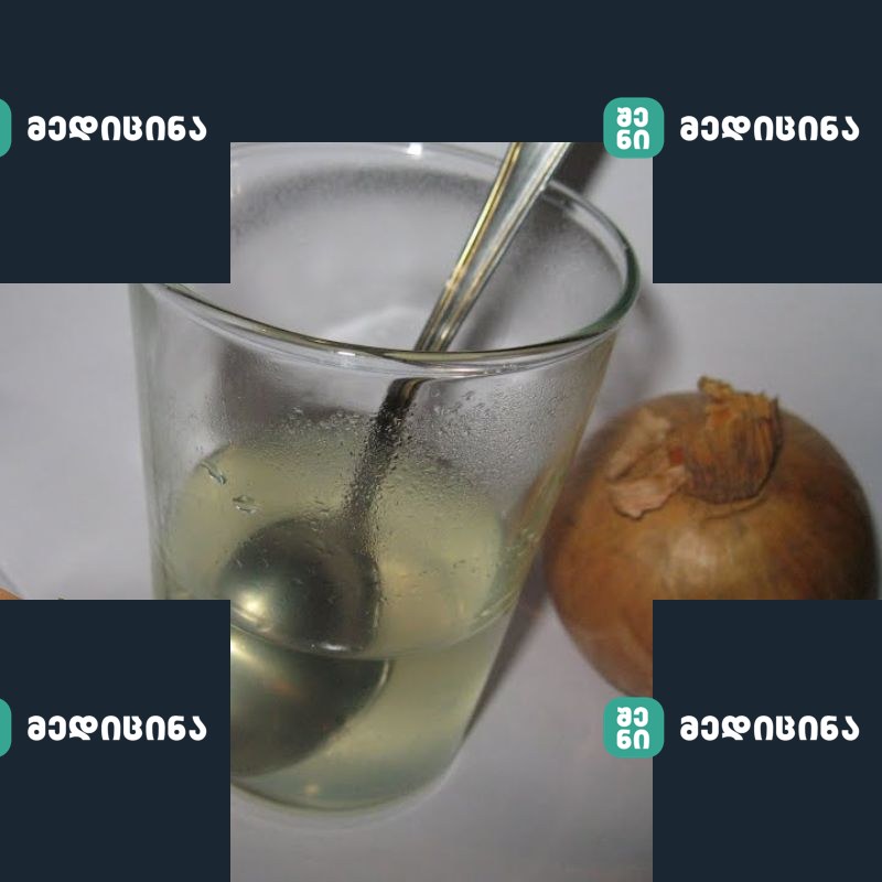 xaxvi 1