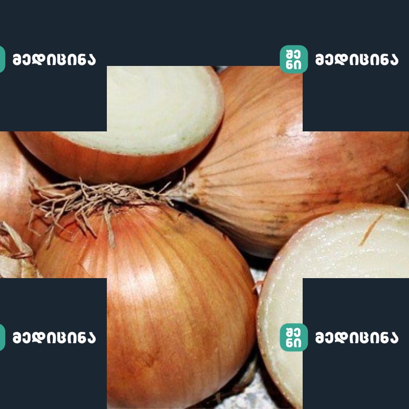 xaxvi 2